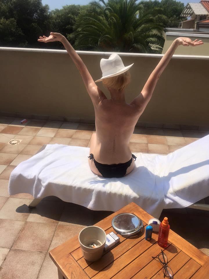 Patty Pravo in topless si abbronza su una sdraio in Versilia