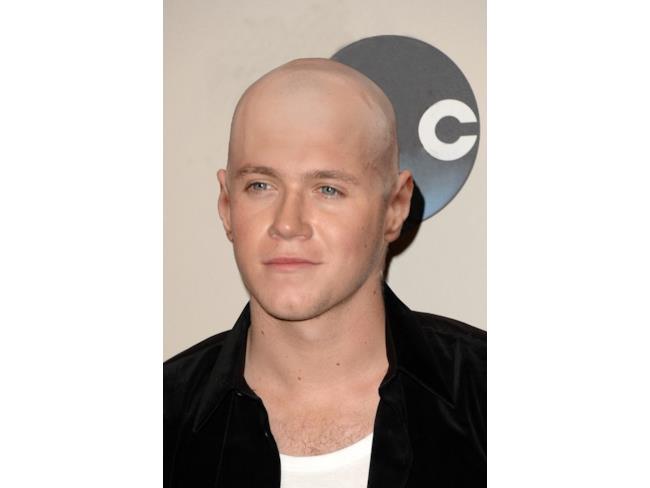 Fotomontaggio di Niall Horan senza capelli