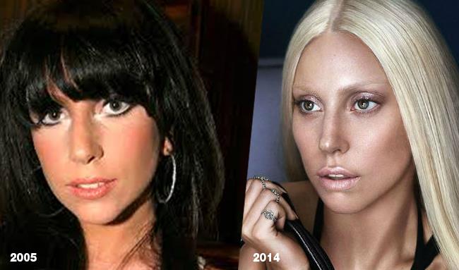Lady Gaga: lifting con il nastro adesivo Lady Gaga primo piano