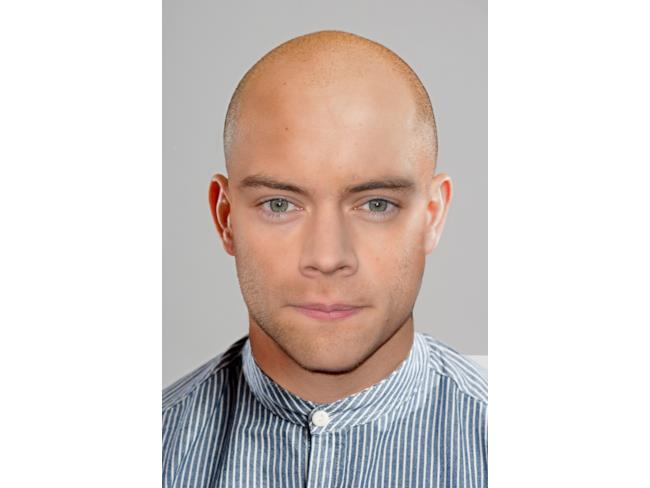 Fotomontaggio di Harry Styles senza capelli