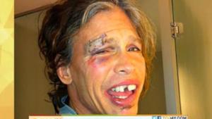 Steven Tyler, la foto e le dichiarazioni dopo la caduta (VIDEO)