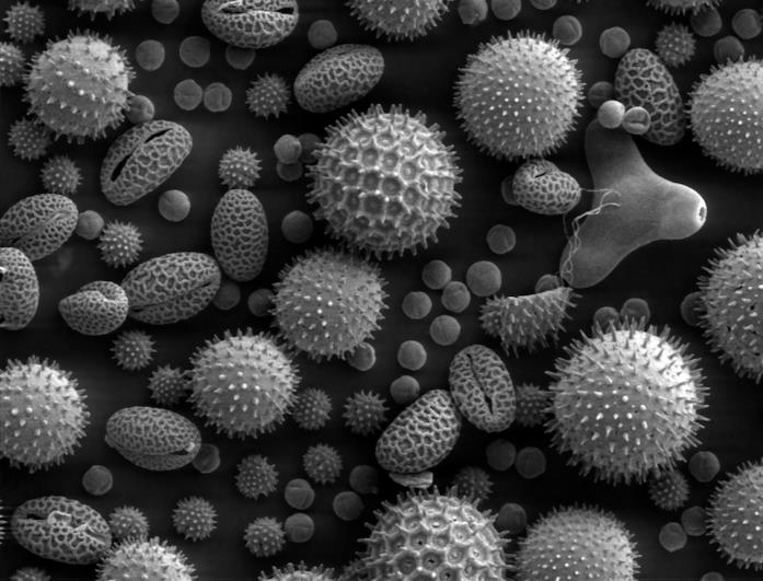 Dei granuli di polline al microscopio elettronico Dei granuli di polline osservati tramite un microscopio elettronico