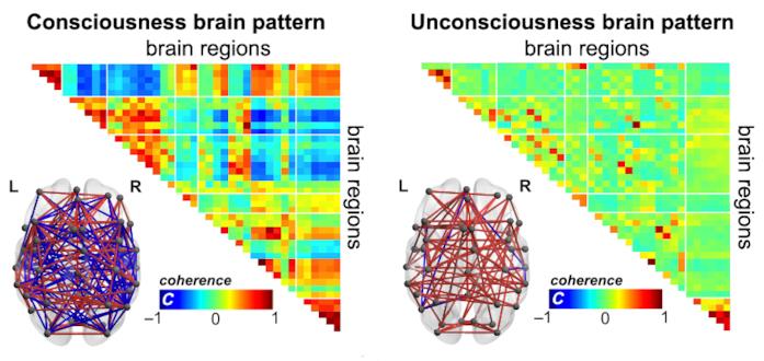 I differenti modelli di coscienza cerebrale Un'immagine raffigurante i differenti modelli di coscienza cerebrale